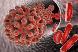 Penis Kalınlaştırma Ameliyatı